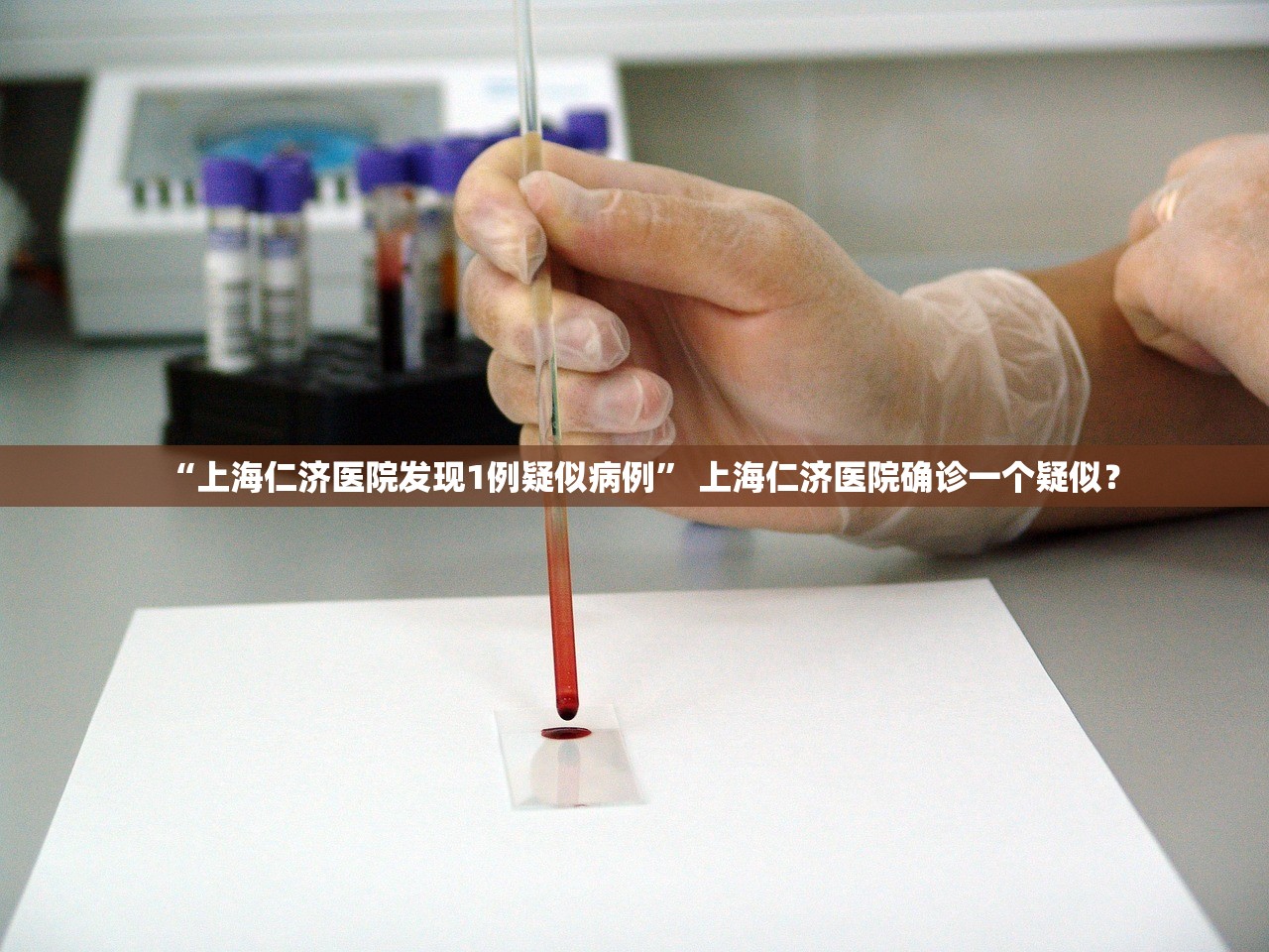 “上海仁济医院发现1例疑似病例	” 上海仁济医院确诊一个疑似？
