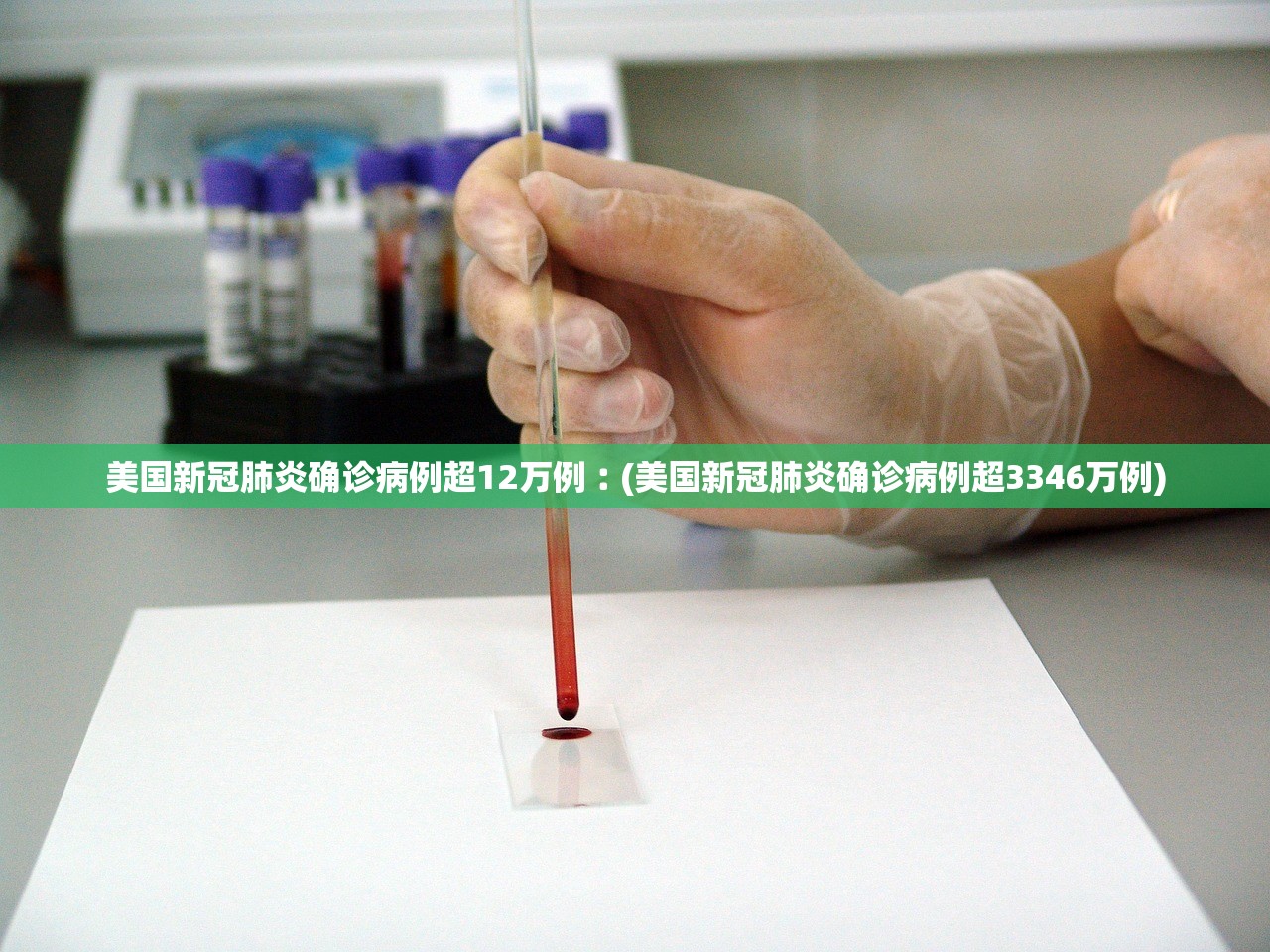 美国新冠肺炎确诊病例超12万例︰(美国新冠肺炎确诊病例超3346万例) 美国新冠肺炎确诊病例超12万例︰(美国新冠肺炎确诊病例超3346万例)